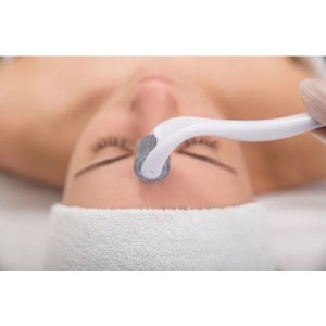 Microneedling