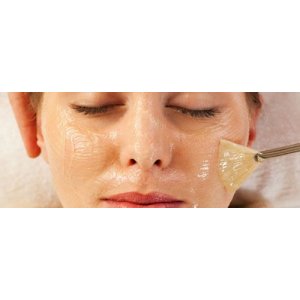 Peeling acido glicolico